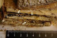 太刀魚のアニサキスについて 太刀魚の塩焼きを食べていた時 気がついたので Yahoo 知恵袋