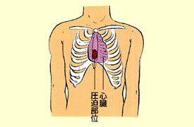 私は内臓逆位で 全部の内臓が普通の人と真逆についています ａｅｄ Yahoo 知恵袋