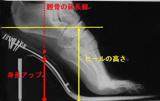 ヒールと実際の身長について ふと疑問に思ったのですが ヒールの高さ分 Yahoo 知恵袋