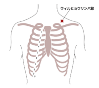 左肩の鎖骨の付け根あたりに ビー玉くらいのしこりがあり 手を伸ば Yahoo 知恵袋