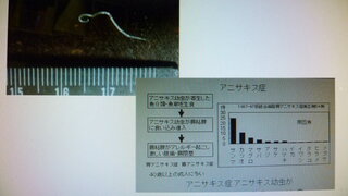 いかの寄生虫 ニベリニア 引っ越してから初めて買った刺身用のイカ 鮮魚 Yahoo 知恵袋
