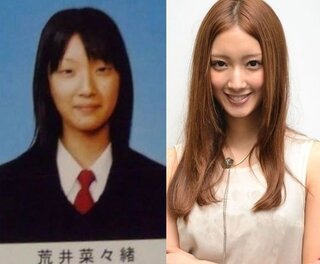 整形している芸能人を教えて下さい 市川由衣 木村佳乃 倉 Yahoo 知恵袋