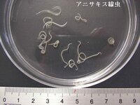 イカの刺身に寄生虫 今日 イカの刺身を半額で鮮魚店で購入しました Yahoo 知恵袋