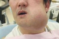 中学一年生です 虫歯について２ｃｈでスレを見て怖くなったので質問 Yahoo 知恵袋