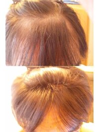 ヘアーマックスを購入検討しています Agaにも効果が期待できるとの事 Yahoo 知恵袋