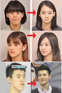 韓国人と日本人の女の子の顔の違いってなんですか 日本人のほうが醤油顔 と思う Yahoo 知恵袋