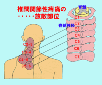 左の肩甲骨の辺りに痛みがあります 一応画像付けてみます赤で色をつけた部分 Yahoo 知恵袋