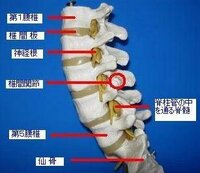 背中 の 痛み 左側 何 科