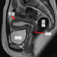 子宮筋腫の検査で生理中の為 お腹の上からのエコーのみでｍｒｉ検査になりました Yahoo 知恵袋