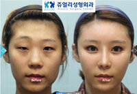 インスタグラムで韓国の女の方がとっても綺麗なのですが 一般の方でもフォトショ Yahoo 知恵袋