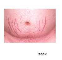 産後のお腹のたるみについて 産後９ヶ月を迎える者です 出産してから 一 Yahoo 知恵袋