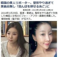 韓国の美容整形の相場っていくらくらいなんですかね あと 韓国の Yahoo 知恵袋