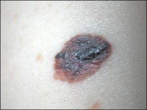 巻き戻す ポーチ 十代の若者たち ほくろ ひっかく Everrite Jp