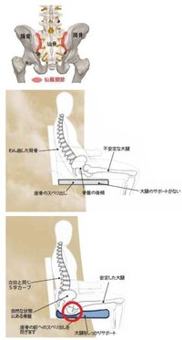 右側の骨盤が痛みます 19歳です 片方だけ足を組む癖や頬杖をつく癖があるのです Yahoo 知恵袋