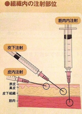 皮下注射シリンジ腹部角度について教えてください よろしくお願いします Yahoo 知恵袋