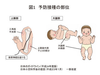 これから 日本脳炎の予防注射を打つんですけど 左手のどこに打 Yahoo 知恵袋