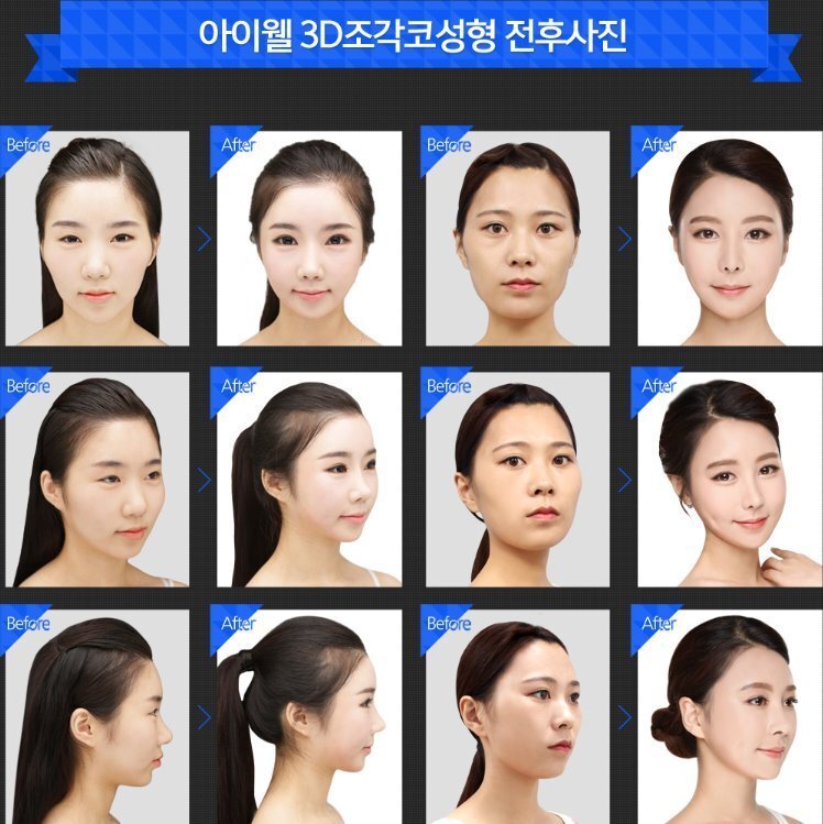 韓国ドラマをちらっと見たら女優が皆同じ顔でおどろいたのですが あれはありなん Yahoo 知恵袋