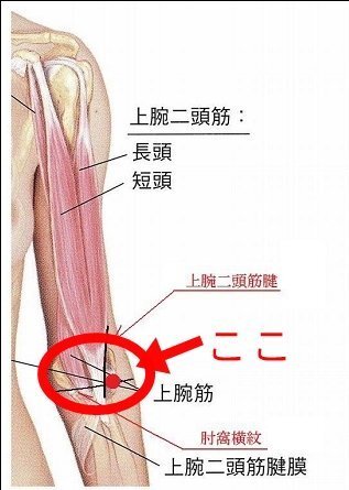 筋肉 痛い の 腕 が
