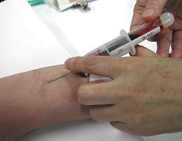 血液検査って痛いの 血抜くのって痛い Yahoo 知恵袋