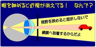 のび太の眼鏡は 眼鏡を外すと目がe イプシロン になるから凸レンズかもしれ Yahoo 知恵袋