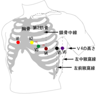 健康診断で心電図をやるときは 男子は服を捲り上げるんですが 女子もそう Yahoo 知恵袋