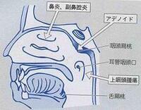 耳管狭窄症 について 北海道在住の者です 今年の6月下旬から 耳管狭 Yahoo 知恵袋