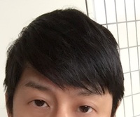 世の中には元々 薄毛でそのままハゲなかったていう人は 年相応で禿げるのは Yahoo 知恵袋