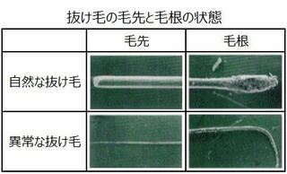 抜け毛について質問です 私の毛根はかなり小さいように思いますが 触って Yahoo 知恵袋