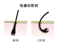 30歳になり 急にくせ毛がひどくなりました もともと 多少はくせ毛でし Yahoo Beauty