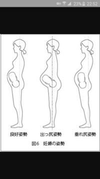 現在妊娠6ヵ月なのですが 4dのエコー検査で 男の子っぽい 女の子か Yahoo 知恵袋