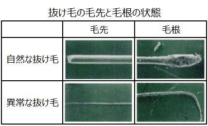 先細りの毛根というのは毛根がないものを言うのでしょうか それとも毛根が小 Yahoo 知恵袋