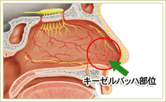月曜日に鼻を子供の頭突きで強打しました もともと 鼻が Yahoo 知恵袋