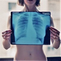 健診で胸部レントゲンを撮られるのはある意味盗撮ってことですか Yahoo 知恵袋