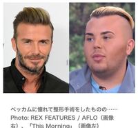 白人の外国人みたいな顔になるためにはどうすればいいですか 男です 整形 Yahoo 知恵袋