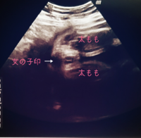 現在24wです 16wで男の子と言われていたのに今日女の子と言 Yahoo 知恵袋