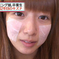 整形手術失敗だなと思う芸能人誰がいますか 私は辻希美目頭 Yahoo 知恵袋