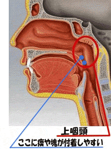 子供でも簡単に痰を出す方法とコツを教えて下い 子供は小学６年生の女の Yahoo 知恵袋