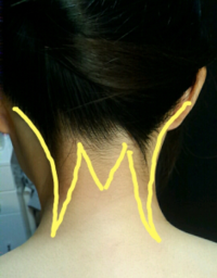 こんなバサバサなうなじでもmw型という剃り方はできますか 理容 Yahoo 知恵袋