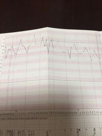 妊娠初期の基礎体温の低下 6w4dの妊婦です 妊娠中から Yahoo 知恵袋