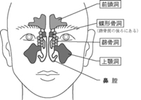 眉間と眉上がとても痛みます 最初は押すと痛い程度でしたが Yahoo 知恵袋