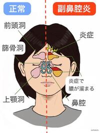 眉間の頭痛について3週間ほど前からおでこの真ん中や眉を押すと激痛が続いてま Yahoo 知恵袋