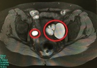 骨盤内mriの見方 右足の股関節を広げると痛いため先日 整形外科でmriを撮り Yahoo 知恵袋
