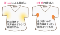 痛み 割合 サーカス シャツ 脇 黄ばみ ワキガ Wjrbt Jp