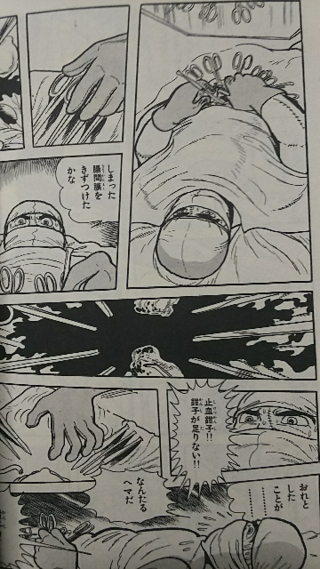 漫画ブラックジャックについて ブラックジャックが自分で自分を手術する Yahoo 知恵袋