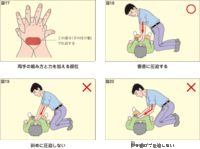 胸骨圧迫 心臓マッサージについて先日応急救護講習で胸骨圧迫を習いました その Yahoo 知恵袋