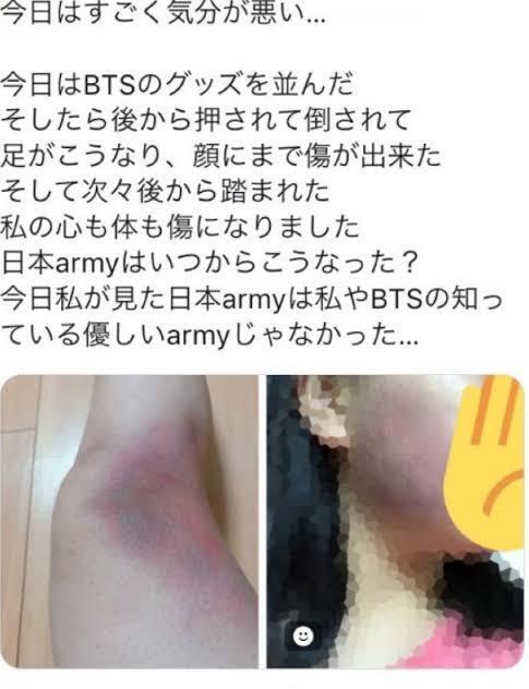 Armyとonceの民度ってどちらのが低いですか 昔はarmy Yahoo 知恵袋