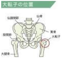 この骨盤の出っ張りって 骨格だからどうしようもないんですよね Yahoo 知恵袋