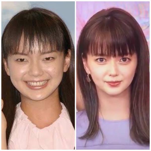 多部未華子さんって昔とだいぶ顔が変わりましたが整形してると思いますか Yahoo 知恵袋