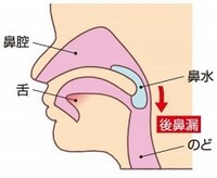 痰の混じった鼻水を飲み込む癖が 知人の影響でついてしまいました鼻から降 Yahoo 知恵袋