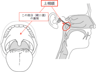 治せ これ は で に 後 のど 張り付く 漏 鼻 流れる